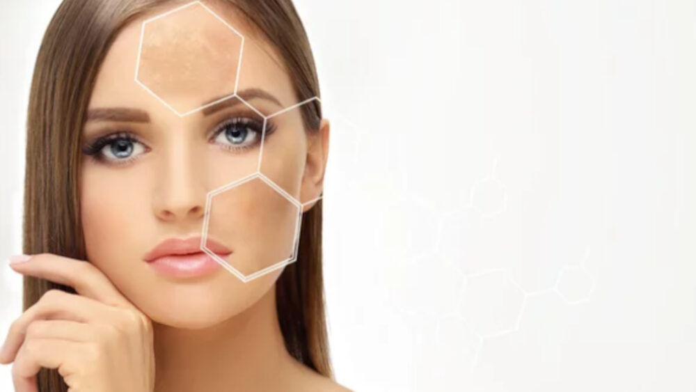 Niedoskonałości – jak stres wpływa na skórę?